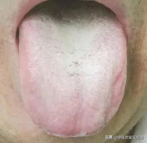 貼桂苓十香散濕貼會(huì)瘦嗎（桂苓十香散濕貼）